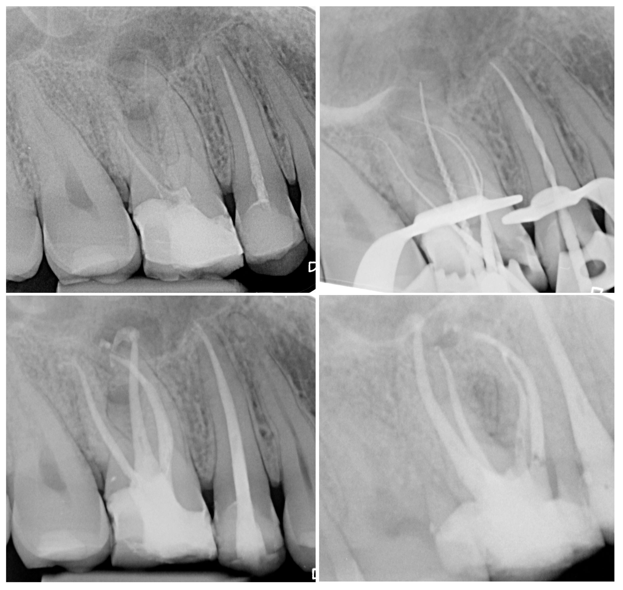 Nicola Grande "Come raggiungere l&rsquo;apice nel 100% dei casi"